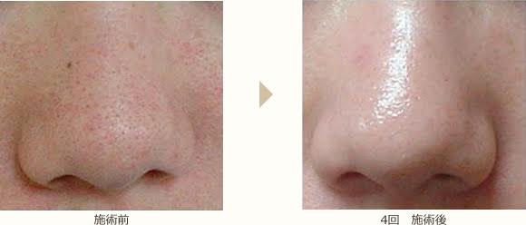 埋め込み画像 2