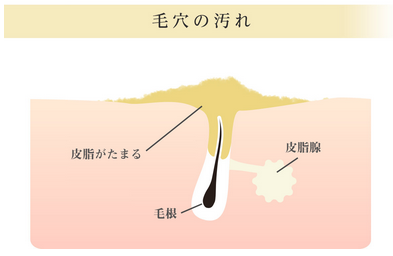 埋め込み画像 2