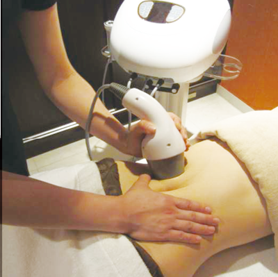 キャビテーション