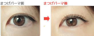 まつ毛を痛めないように細心の注意をしながら、ロットに1本1本のまつ毛を丁寧に巻きつけ、理想のカールに仕上げます。