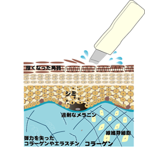 埋め込み画像 2