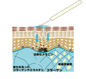 埋め込み画像 3