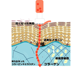 埋め込み画像 4