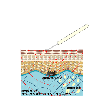 埋め込み画像 8